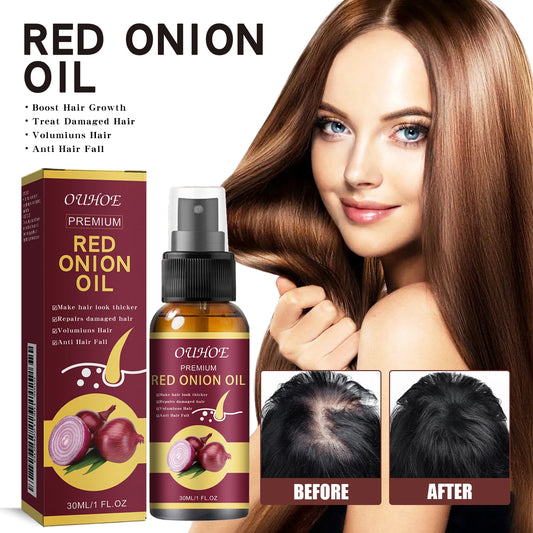 Croissance des cheveux à l'oignon rouge Huile essentielle Spray de soin des cheveux Prévenir la perte de cheveux Nourrir les racines des cheveux Améliorer la texture des cheveux Produits de soins capillaires